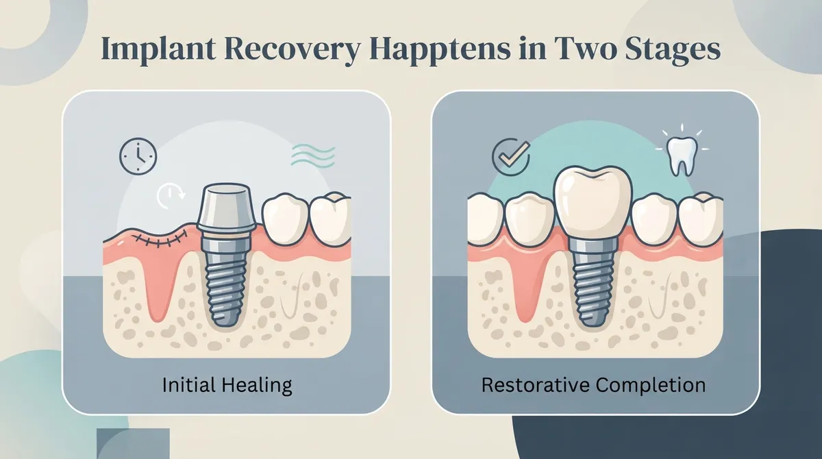 how long is implant recovery
