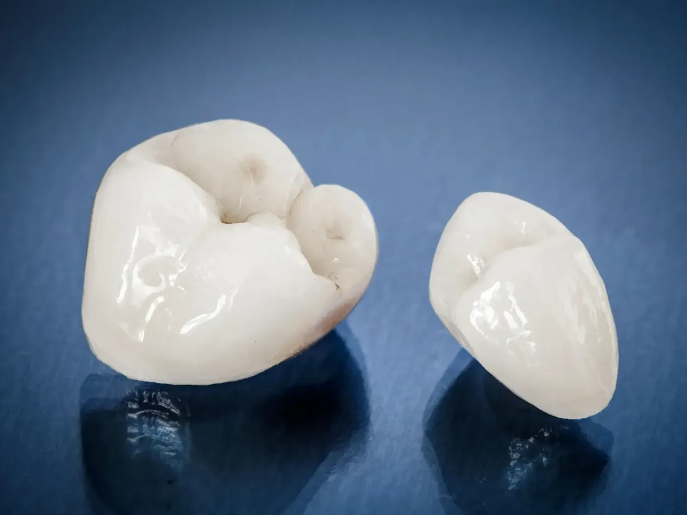 Custom dental crown and bridge restorations