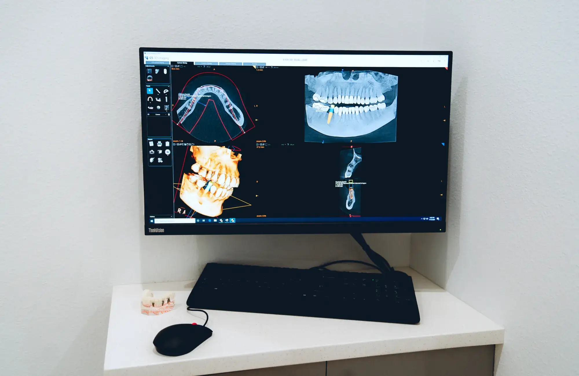 Advanced 3D dental implant planning at Charming Smiles of Ocoee